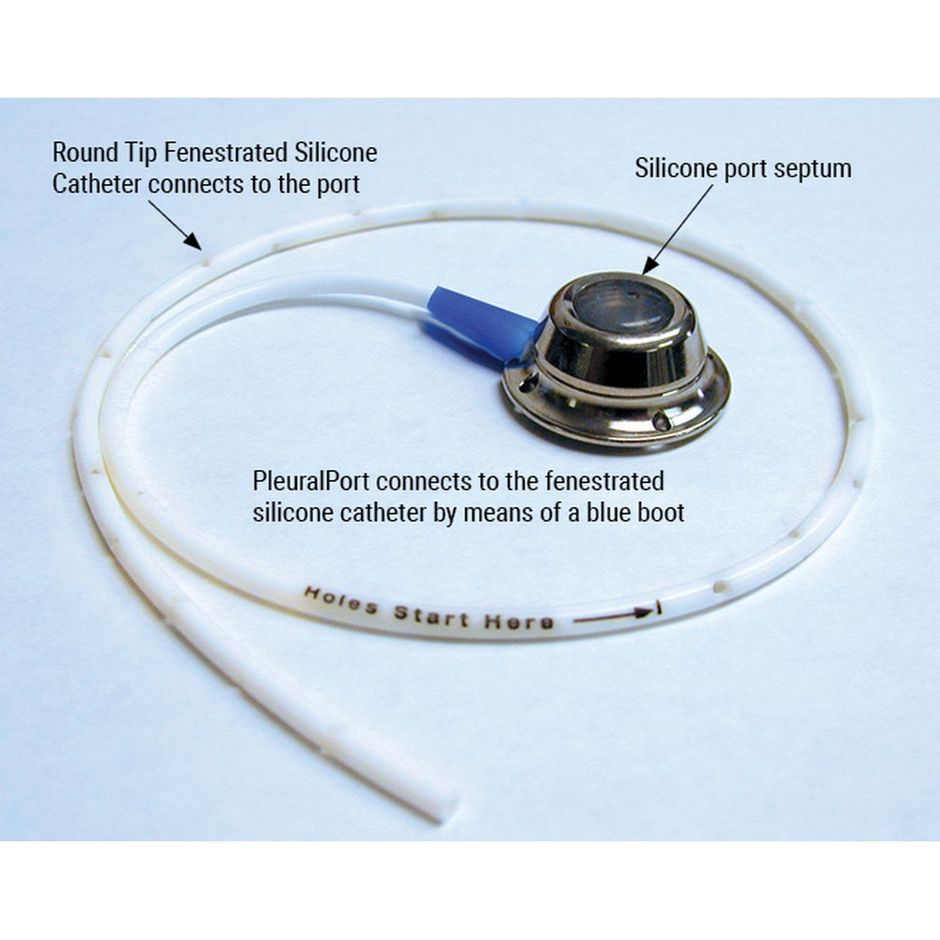 Norfolk PleuralPort Kit