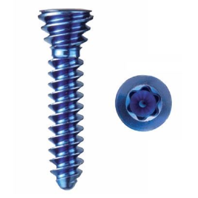 Knight Benedikt 2.0mm Titanium Arix Locking Screw