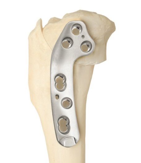 VOI Versiv Curved Locking TPLO Plate