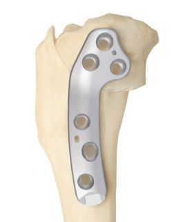 VOI Compresiv Curved Locking TPLO Plate